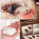 2 His whole body was itching, he thought it was an allergy, and he was diagnosed.… See more