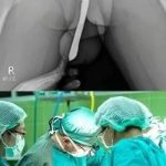 Doctors are speechless: Just boil these 2 ingredients and you will quickly lose your body fat !!